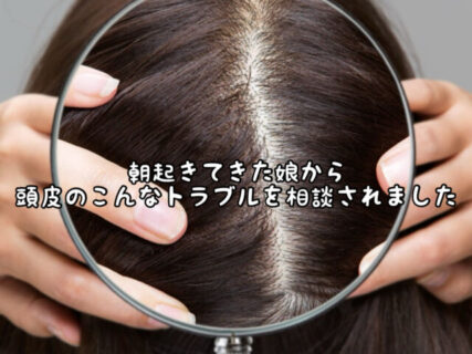 【紫外線】想像以上に今の季節は頭皮も日焼けしやすいので気をつけましょう