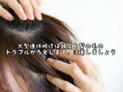【要注意】大型連休明けは髪と頭皮のトラブル続出！？その訳とは。。。