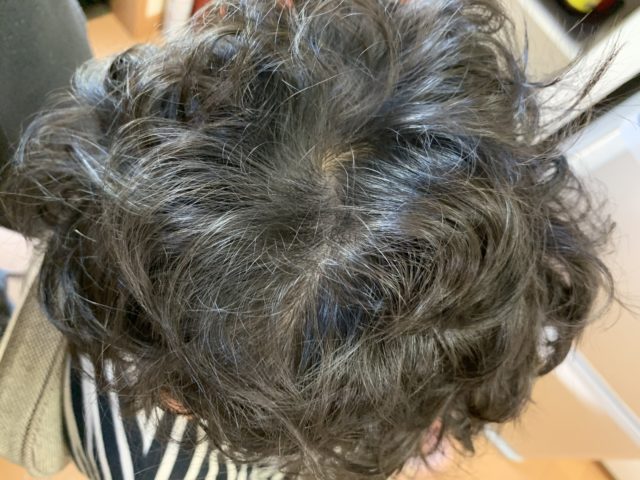 毛流 あなたはどっち巻き つむじの 右巻き と 左巻き の不思議 愛知県 西尾市の美容室age アージュ アンチエイジングケアに特化したヘアサロン